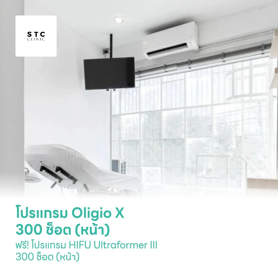 โปรแกรม Oligio X 300 ช็อต (หน้า) ฟรี! โปรแกรม HIFU Ultraformer III 300 ช็อต (หน้า)