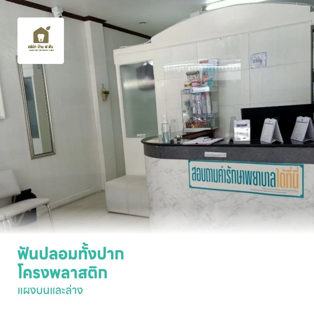 ฟันปลอมทั้งปาก โครงพลาสติก แผงบนและล่าง