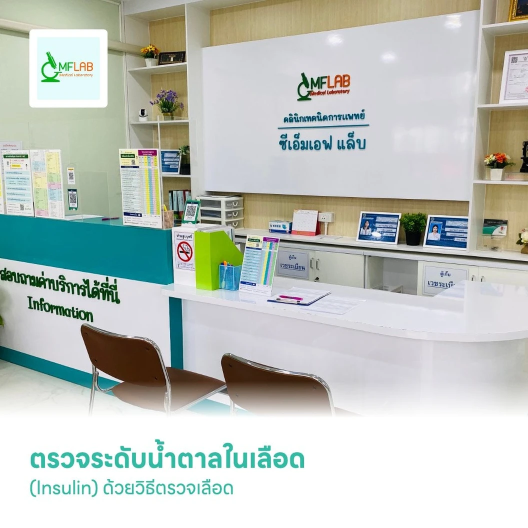 ตรวจระดับน้ำตาลในเลือด (Insulin) ด้วยวิธีตรวจเลือด