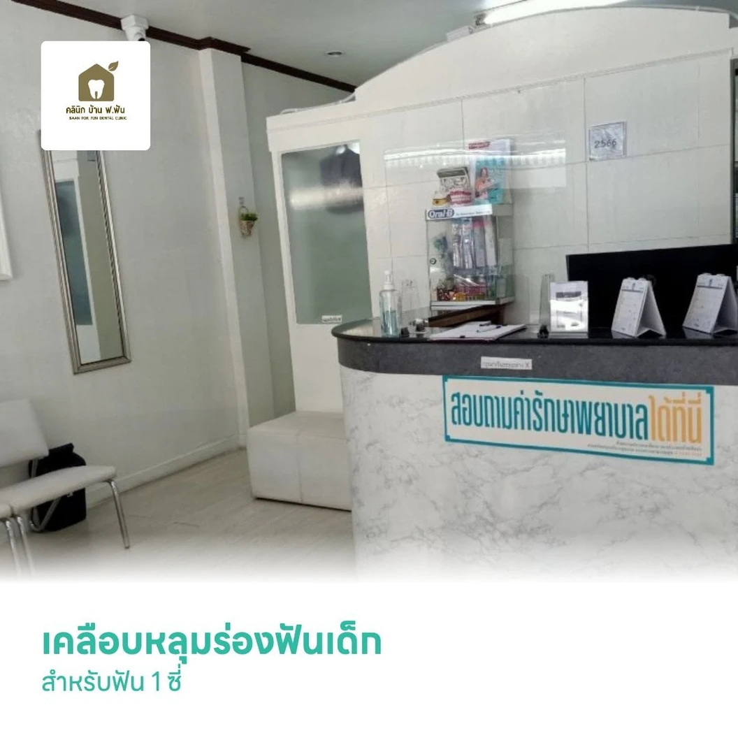 เคลือบหลุมร่องฟันเด็ก สำหรับฟัน 1 ซี่