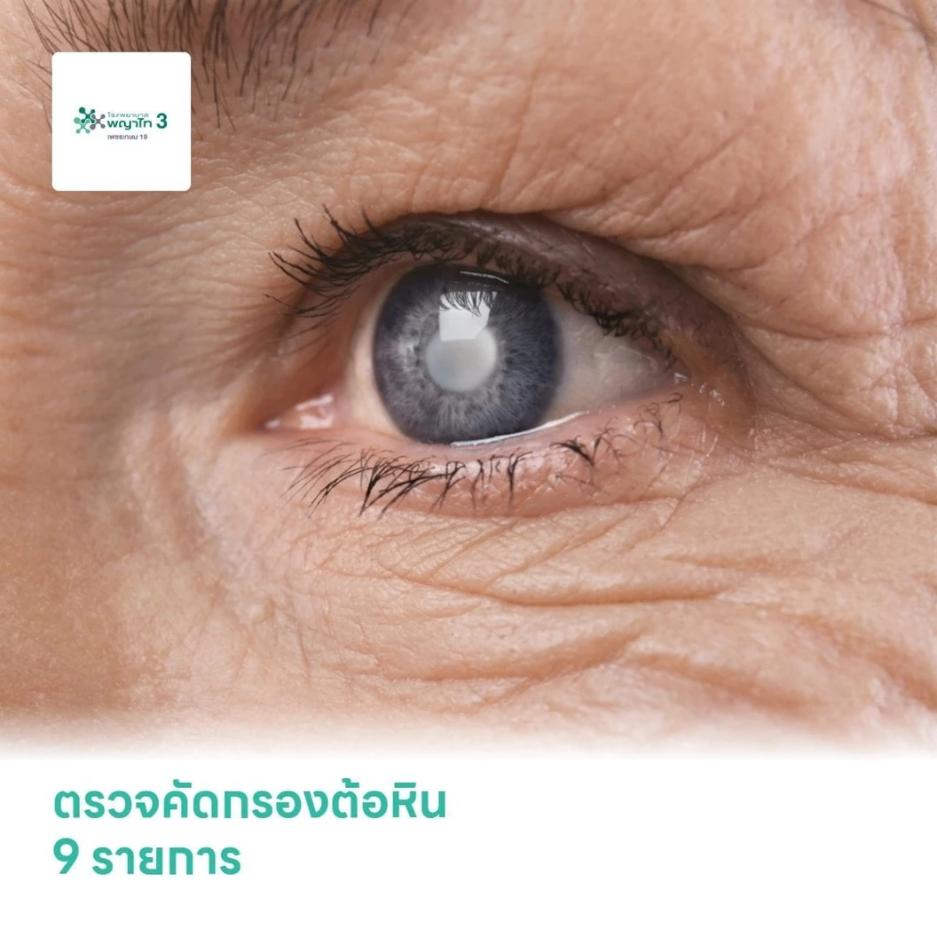 ตรวจคัดกรองต้อหิน 9 รายการ