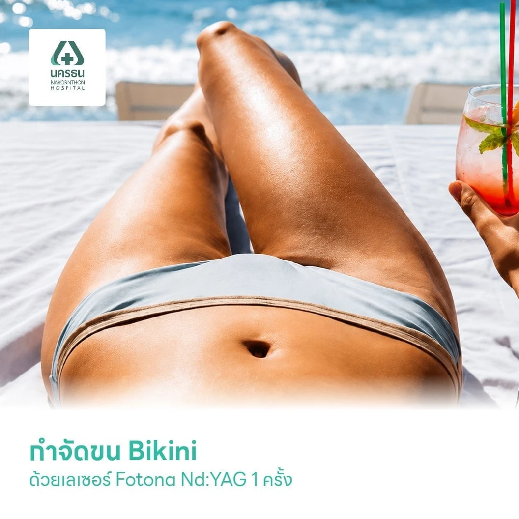 กำจัดขน Bikini ด้วยเลเซอร์ Fotona Nd:YAG 1 ครั้ง