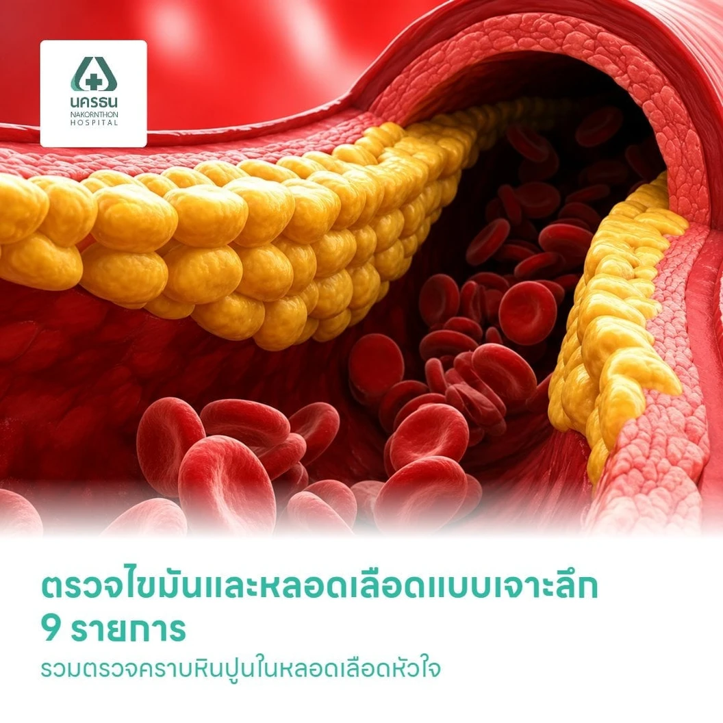 ตรวจไขมันและหลอดเลือดแบบเจาะลึก 9 รายการ รวมตรวจคราบหินปูนในหลอดเลือดหัวใจ (CT Calcium Score) (35 ปีขึ้นไป)