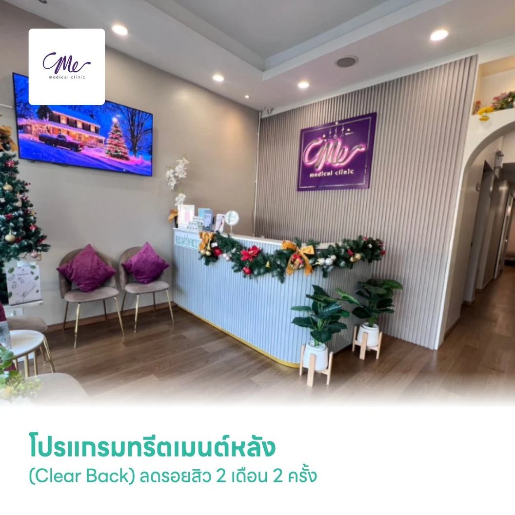โปรแกรมทรีตเมนต์หลัง (Clear Back) ลดรอยสิว 2 เดือน 2 ครั้ง