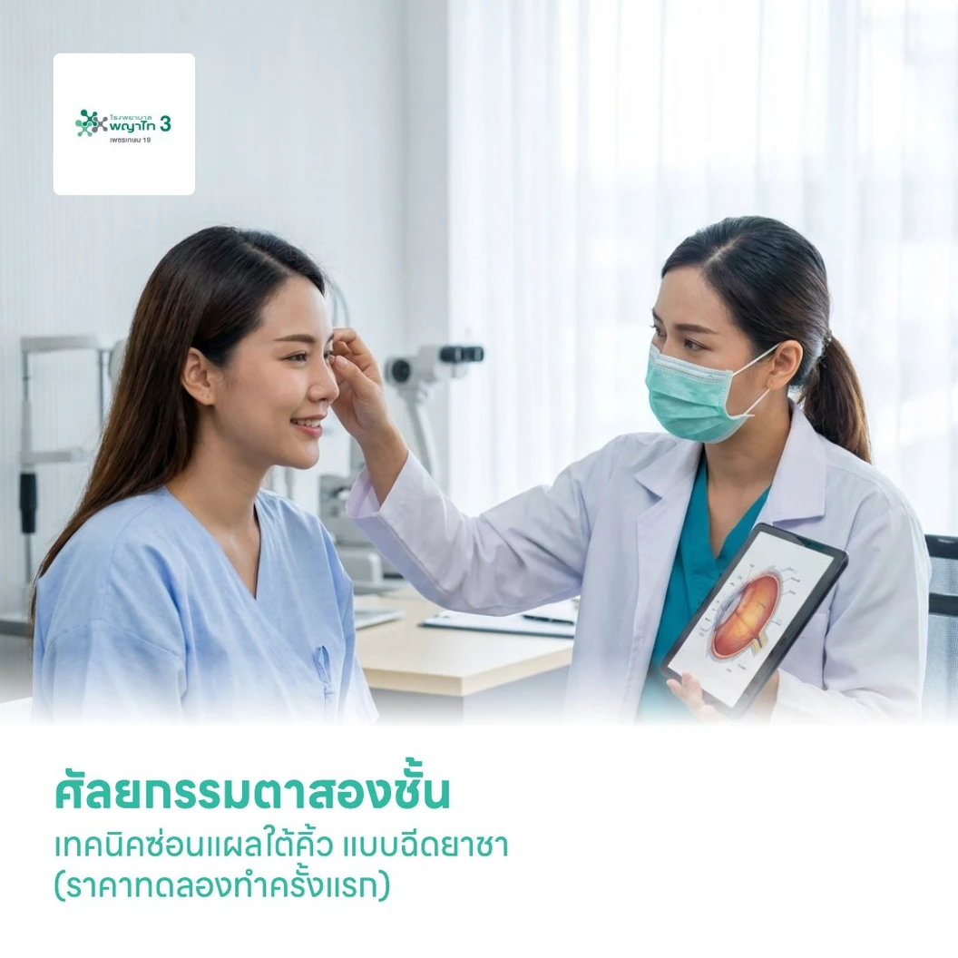 ศัลยกรรมตาสองชั้น เทคนิคซ่อนแผลใต้คิ้ว แบบฉีดยาชา (ราคาทดลองทำครั้งแรก)