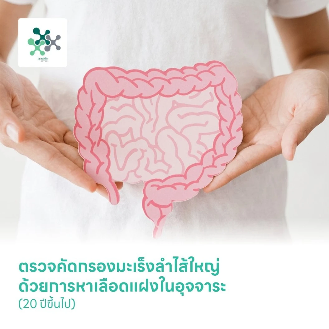 ตรวจคัดกรองมะเร็งลำไส้ใหญ่ ด้วยการหาเลือดแฝงในอุจจาระ (Stool Occult Blood Test) (20 ปีขึ้นไป)