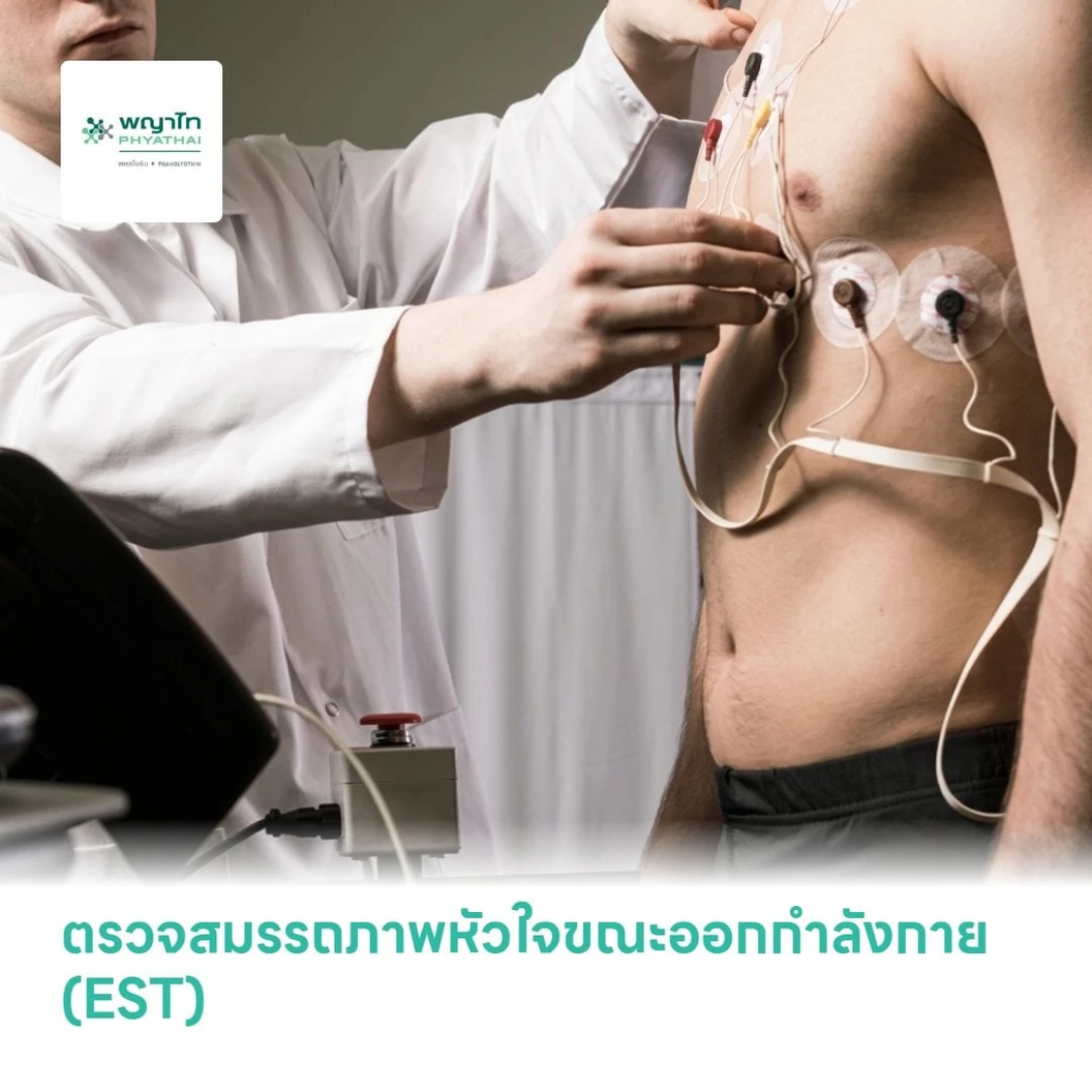 ตรวจสมรรถภาพหัวใจขณะออกกำลังกาย (EST)