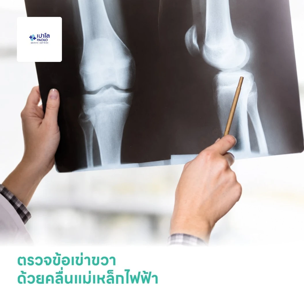 ตรวจข้อเข่าขวา ด้วยคลื่นแม่เหล็กไฟฟ้า (MRI RT Knee)