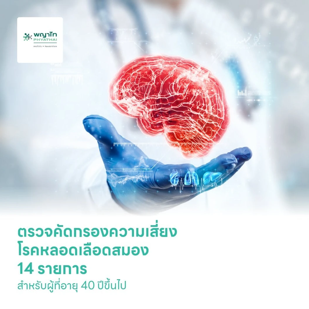 ตรวจคัดกรองความเสี่ยงโรคหลอดเลือดสมอง 14 รายการ (โปรแกรม Stroke For Life Platinum) สำหรับผู้ที่อายุ 40 ปีขึ้นไป