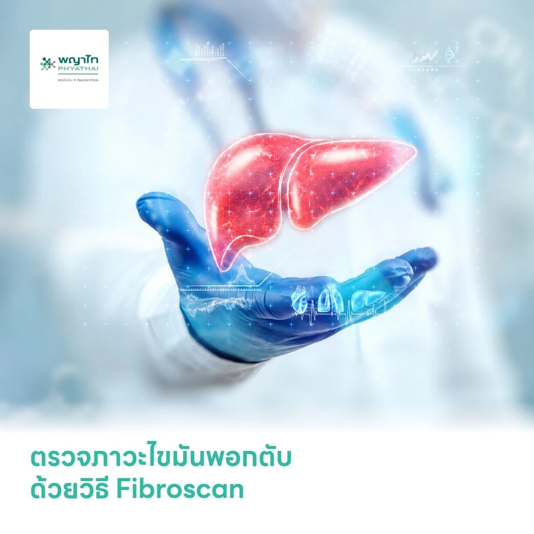 ตรวจภาวะไขมันพอกตับ ด้วยวิธี Fibroscan