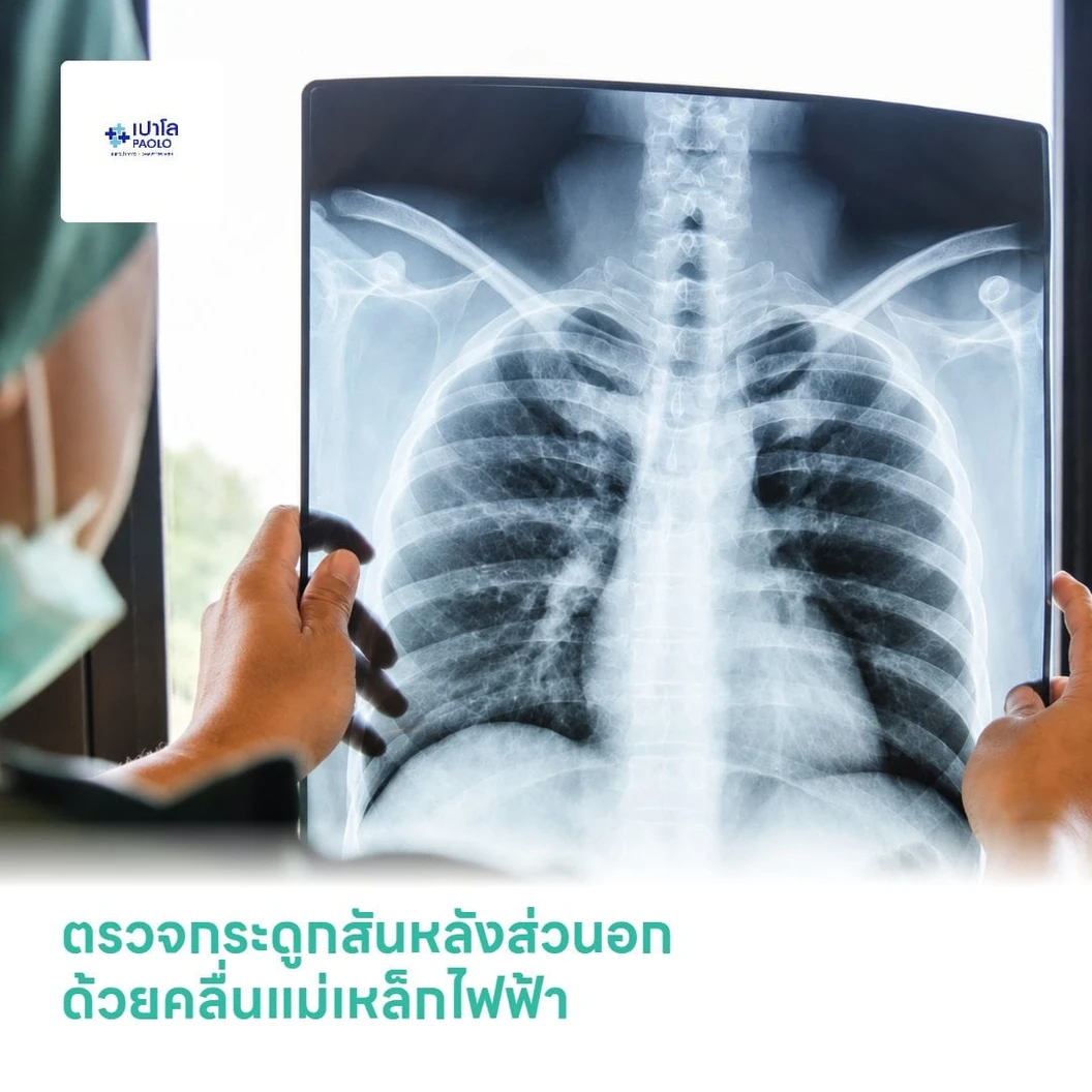 ตรวจกระดูกสันหลังส่วนอก ด้วยคลื่นแม่เหล็กไฟฟ้า (MRI Thoracic Spine)