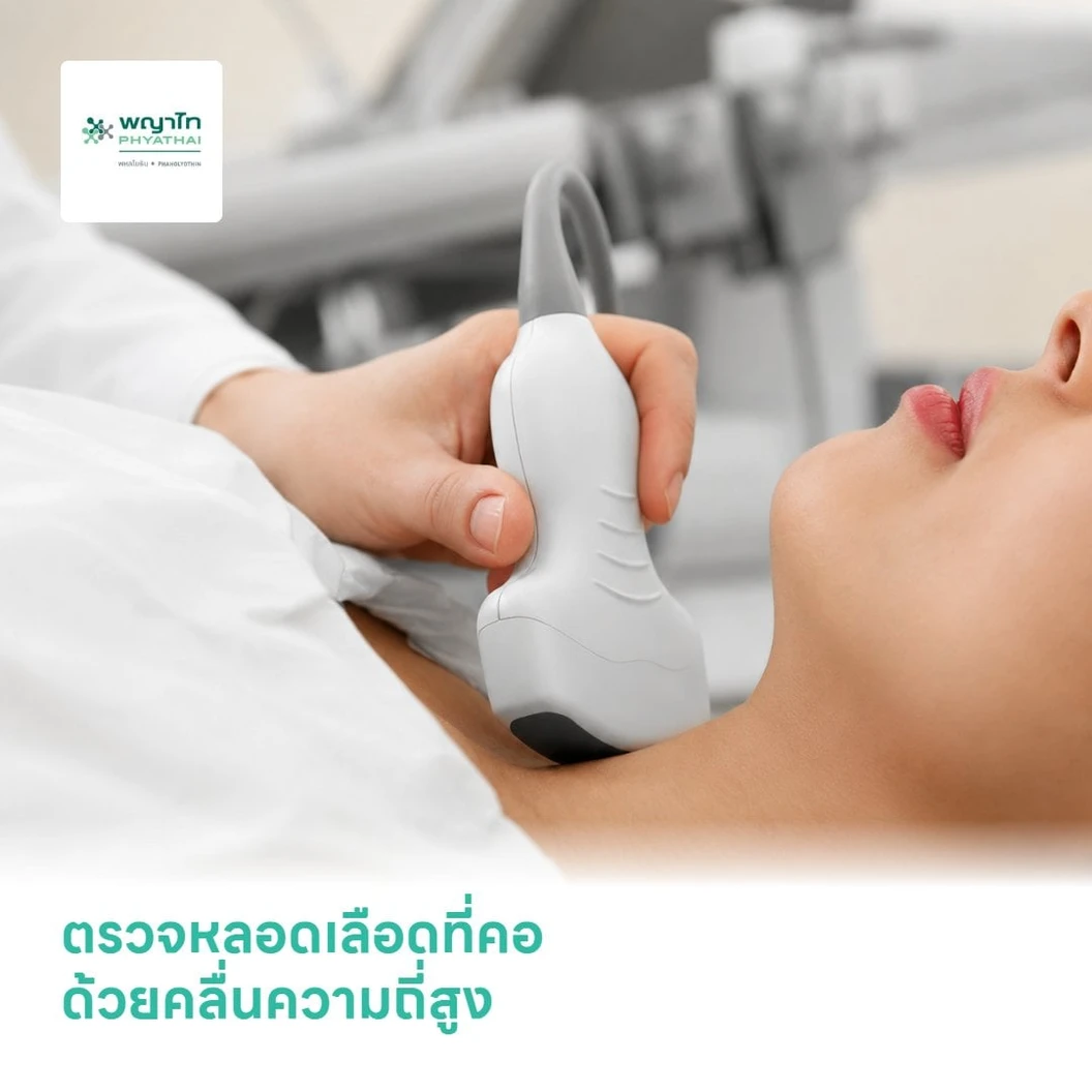 ตรวจหลอดเลือดที่คอ ด้วยคลื่นความถี่สูง (Ultrasound Doppler Carotid Duplex)