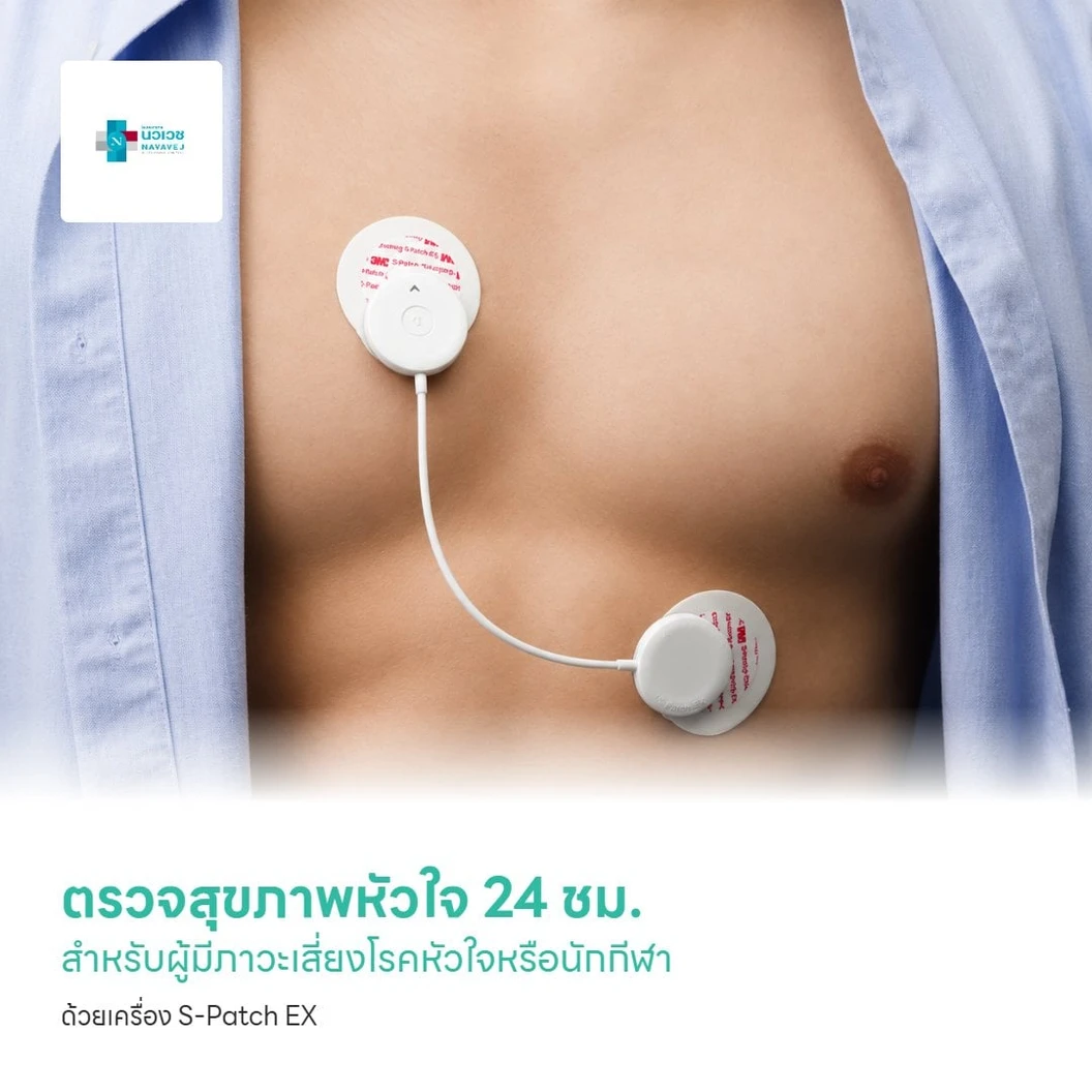 ตรวจสุขภาพหัวใจสำหรับผู้มีภาวะเสี่ยงโรคหัวใจหรือนักกีฬา ด้วยเครื่อง S-Patch EX 24 ชั่วโมง