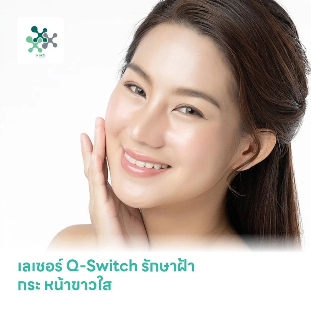 เลเซอร์ Q-Switch รักษาฝ้า กระ หน้าขาวใส