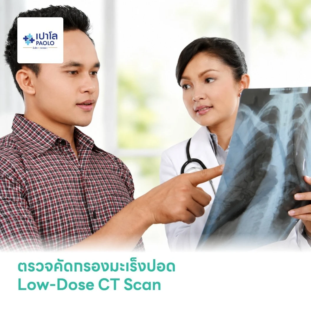 ตรวจคัดกรองมะเร็งปอด Low-Dose CT Scan