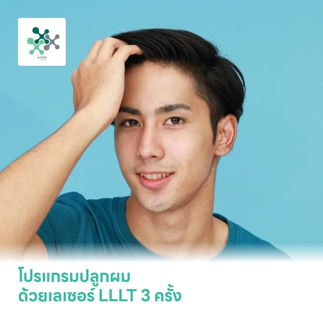 โปรแกรมปลูกผม ด้วยเลเซอร์ LLLT 3 ครั้ง