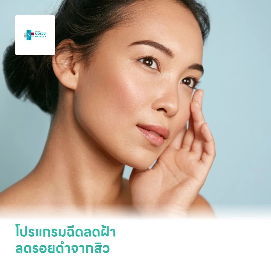 โปรแกรมฉีดลดฝ้า ลดรอยดำจากสิว