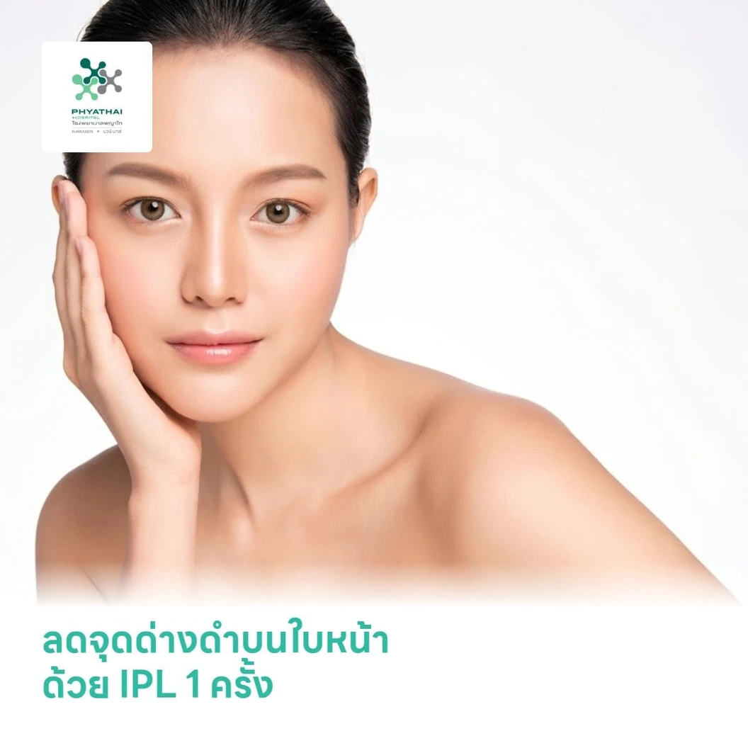 ลดจุดด่างดำบนใบหน้า ด้วย IPL 1 ครั้ง