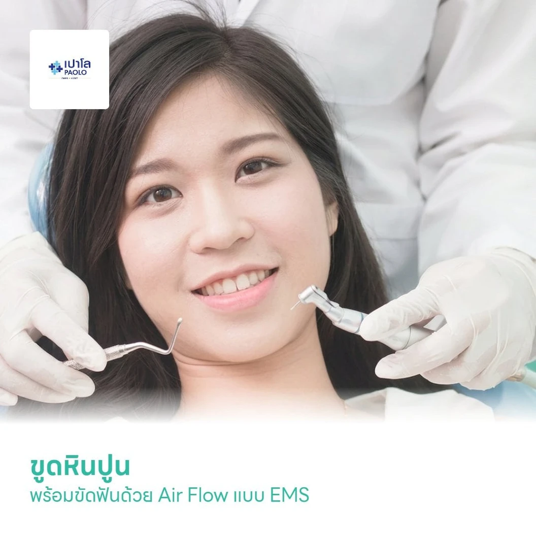 ขูดหินปูน พร้อมขัดฟันด้วย Air Flow แบบ EMS