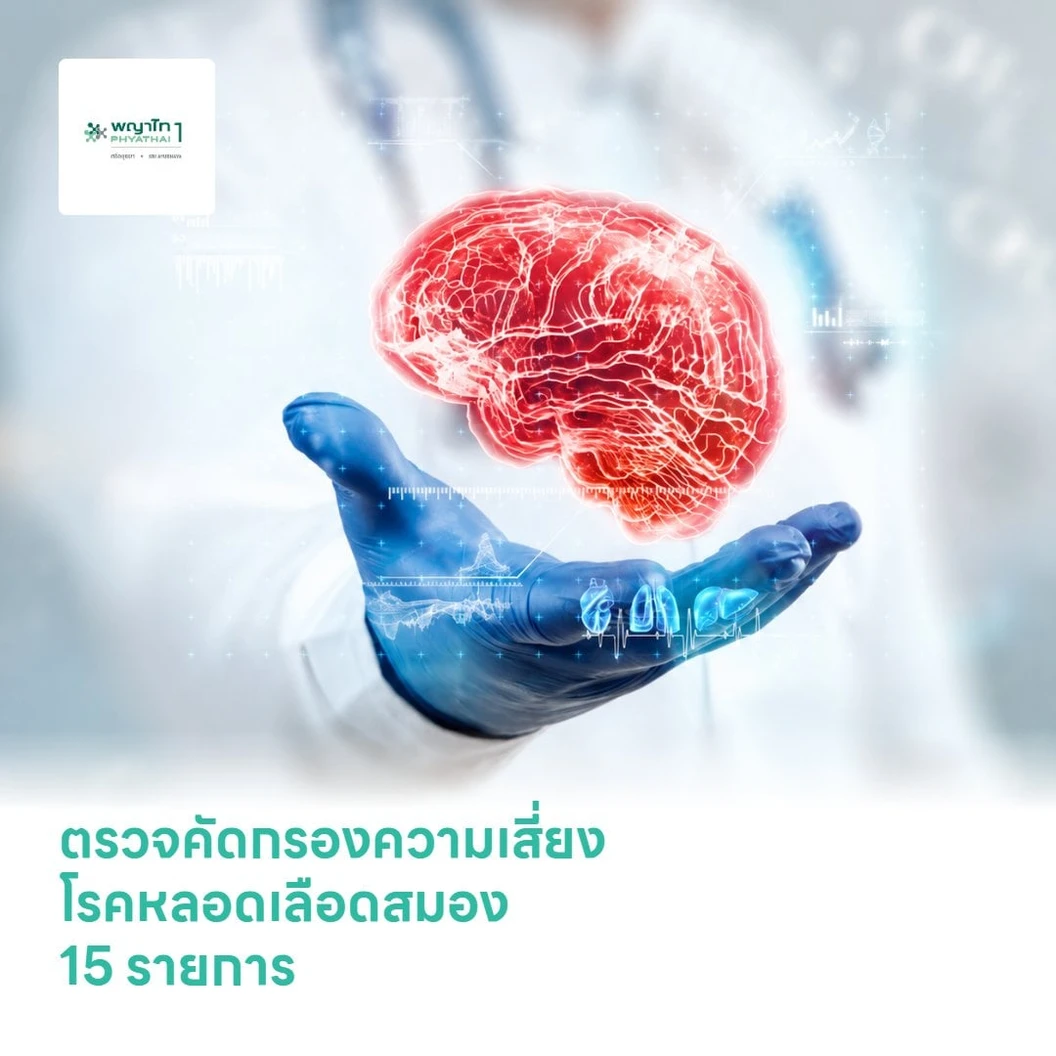 ตรวจคัดกรองความเสี่ยงโรคหลอดเลือดสมอง 15 รายการ โปรแกรม Stroke Check