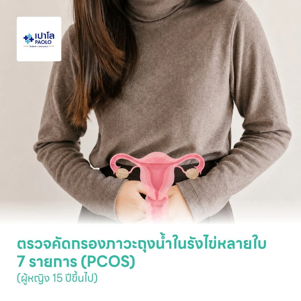 ตรวจคัดกรองภาวะถุงน้ำในรังไข่หลายใบ 7 รายการ (PCOS) (ผู้หญิง 15 ปีขึ้นไป)