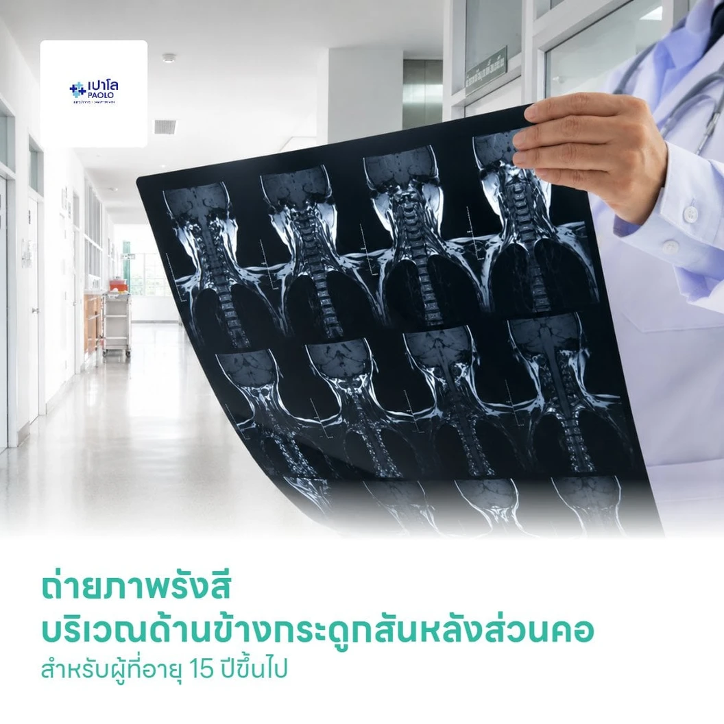 ถ่ายภาพรังสีบริเวณด้านข้างกระดูกสันหลังส่วนคอ สำหรับผู้ที่อายุ 15 ปีขึ้นไป
