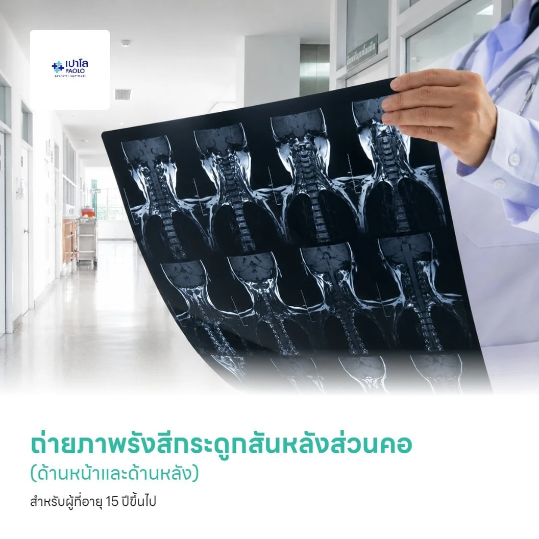 ถ่ายภาพรังสีกระดูกสันหลังส่วนคอ (ด้านหน้าและด้านหลัง) สำหรับผู้ที่อายุ 15 ปีขึ้นไป