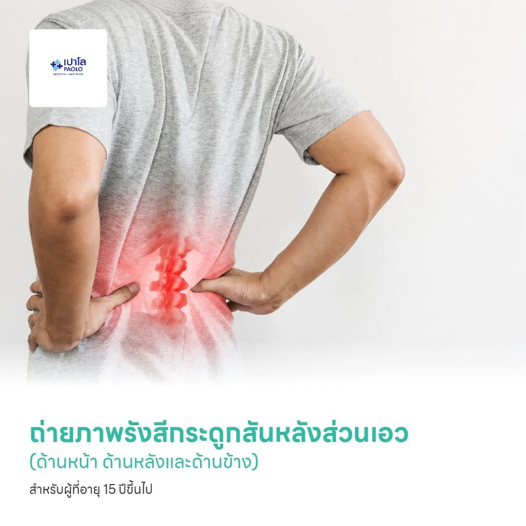 ถ่ายภาพรังสีกระดูกสันหลังส่วนเอว (ด้านหน้า ด้านหลังและด้านข้าง) สำหรับผู้ที่อายุ 15 ปีขึ้นไป