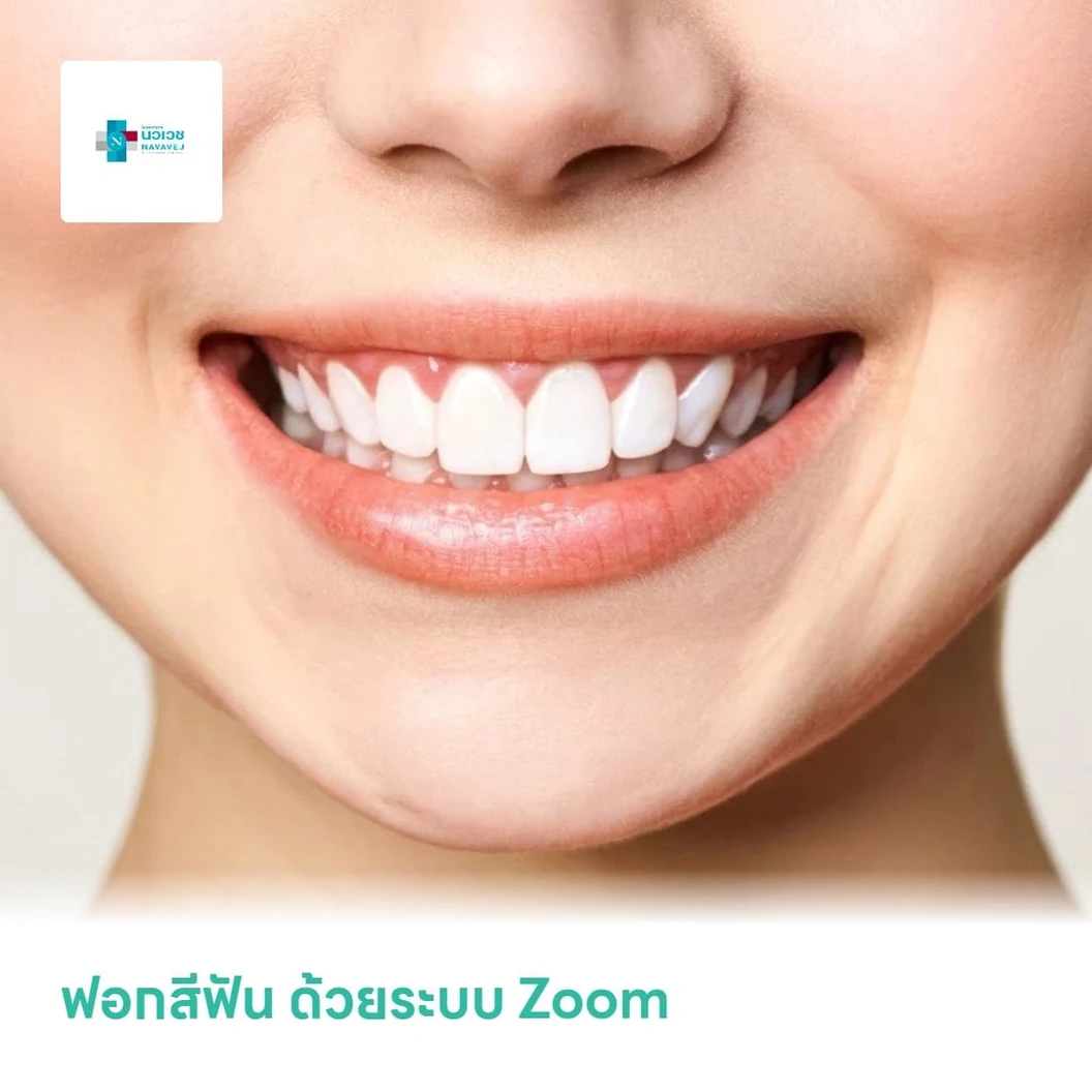 ฟอกสีฟัน ด้วยระบบ Zoom