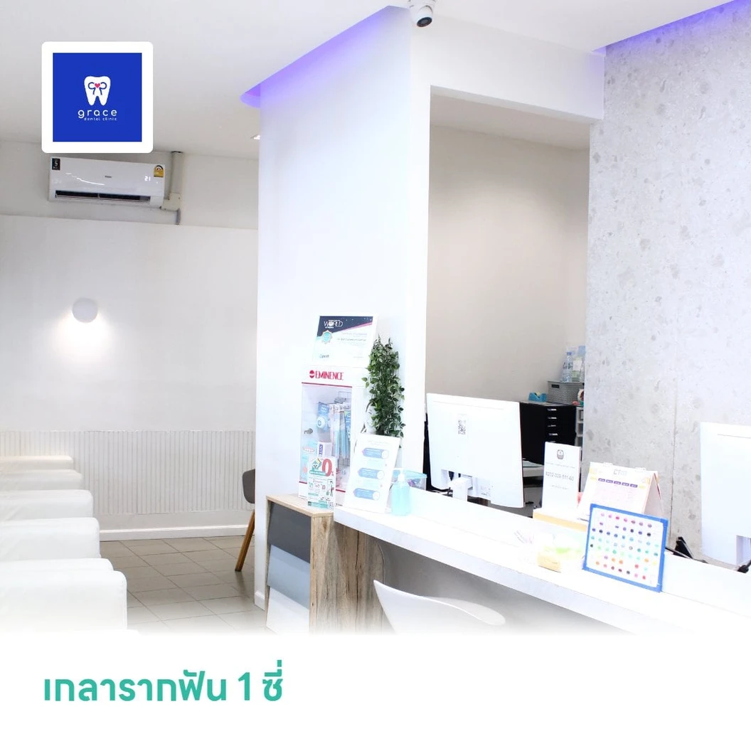 เกลารากฟัน 1 ซี่
