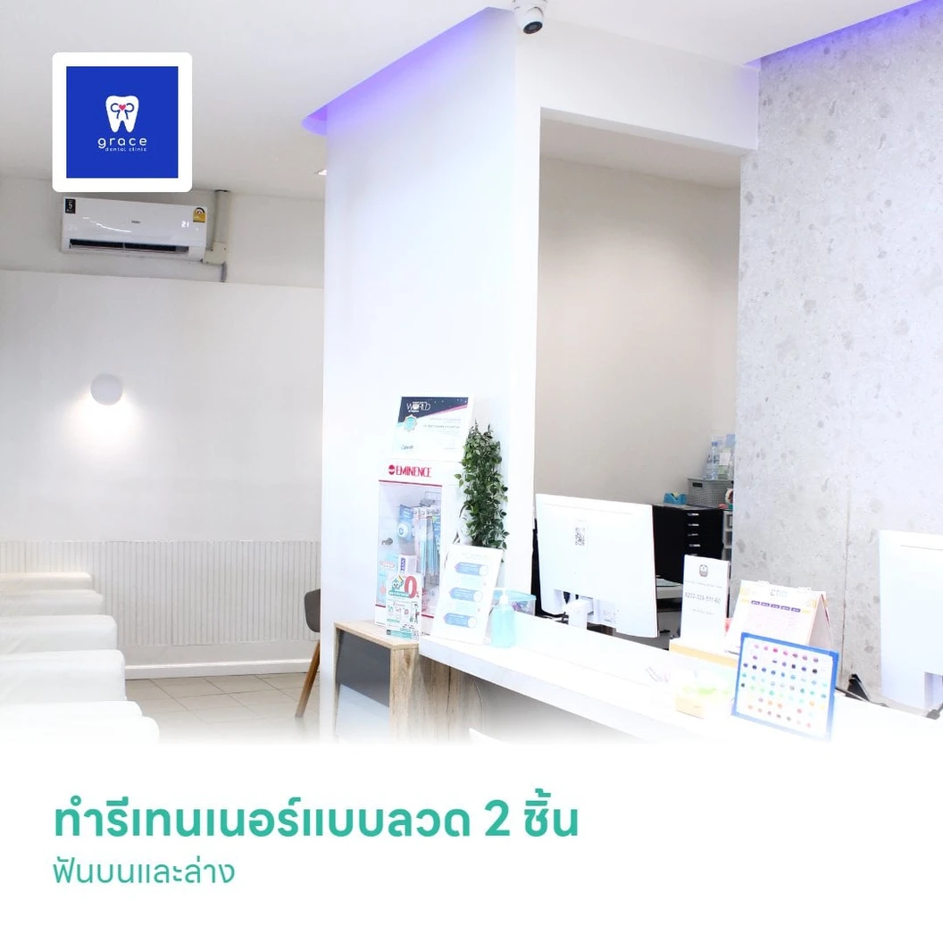 ทำรีเทนเนอร์แบบลวด 2 ชิ้น ฟันบนและล่าง