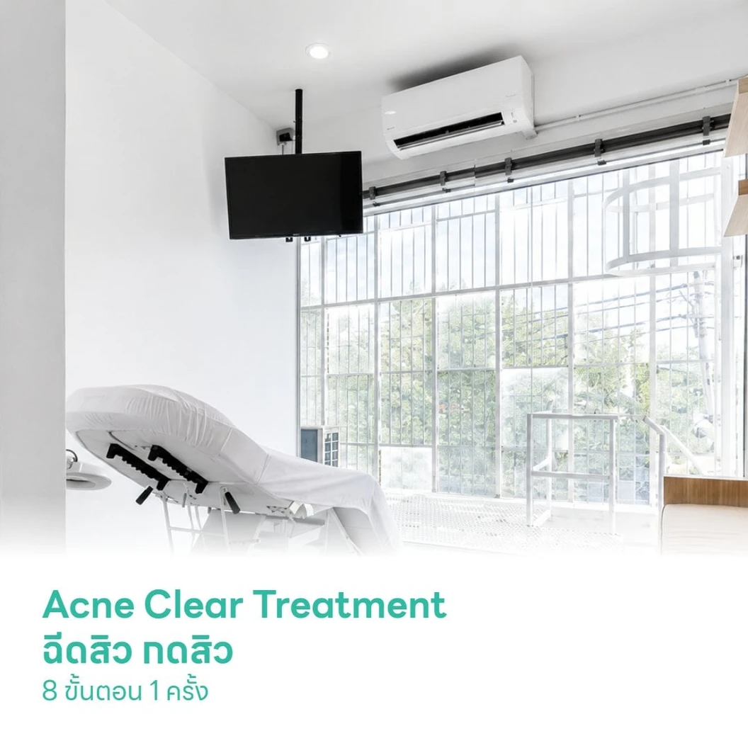 Acne Clear Treatment ฉีดสิว กดสิว 8 ขั้นตอน 1 ครั้ง