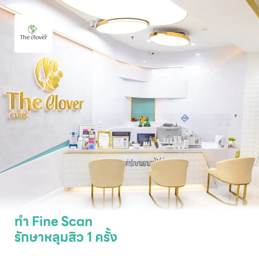 ทำ Fine Scan รักษาหลุมสิว 1 ครั้ง