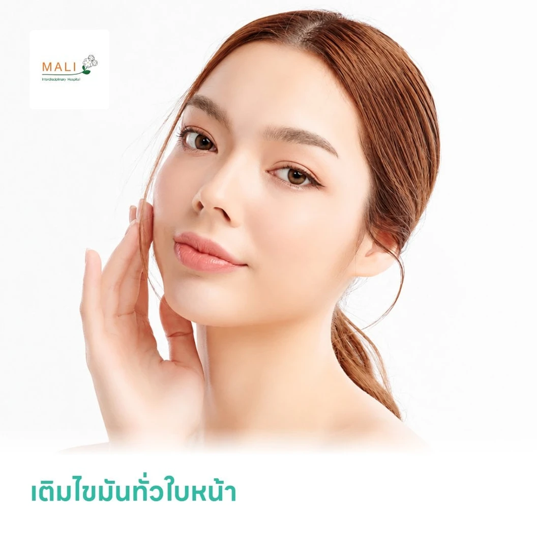 เติมไขมันทั่วใบหน้า ปริมาณและจุดที่ฉีดขึ้นอยู่กับแพทย์ประเมิน