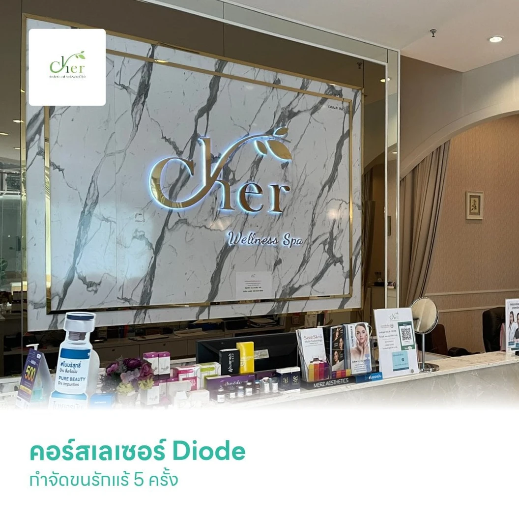 คอร์สเลเซอร์ Diode กำจัดขนรักแร้ 5 เดือน 5 ครั้ง