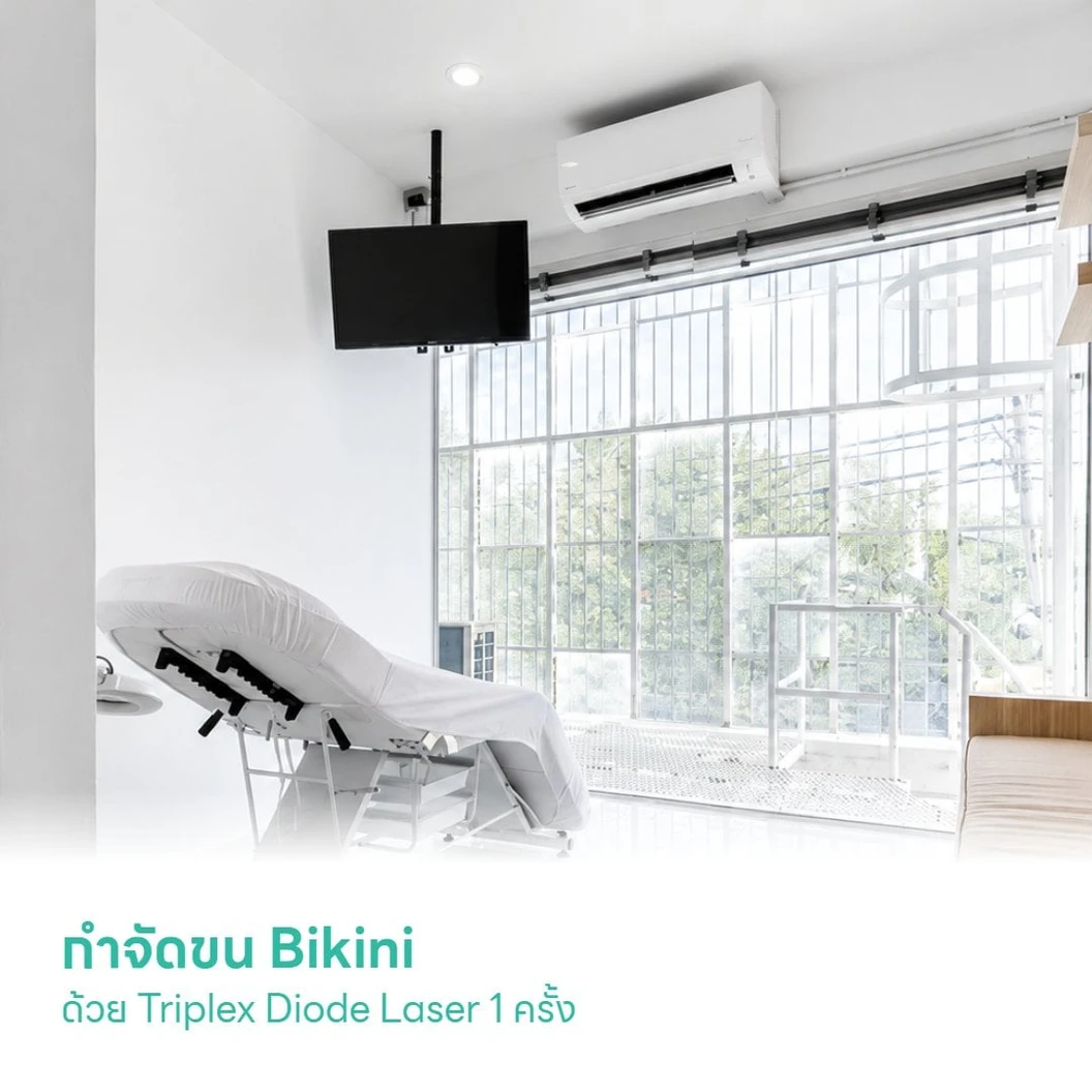กำจัดขน Bikini ด้วย Triplex Diode Laser 1 ครั้ง สำหรับผู้หญิงหรือผู้ชาย