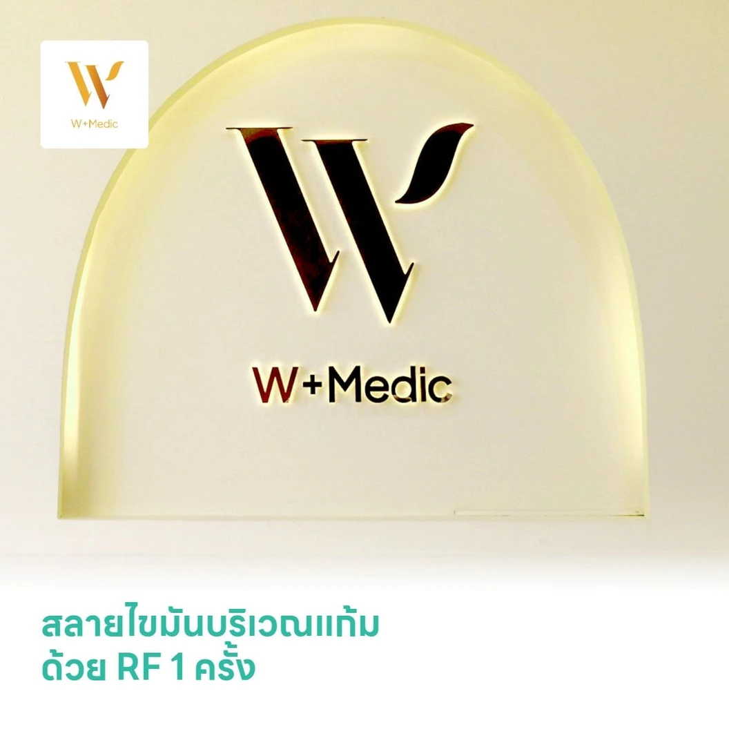 สลายไขมันบริเวณแก้ม ด้วย RF 1 ครั้ง