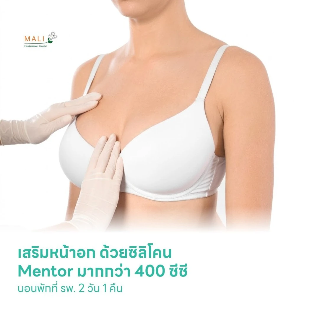 เสริมหน้าอก ด้วยซิลิโคน Mentor มากกว่า 400 ซีซี นอนพักที่ รพ. 2 วัน 1 คืน