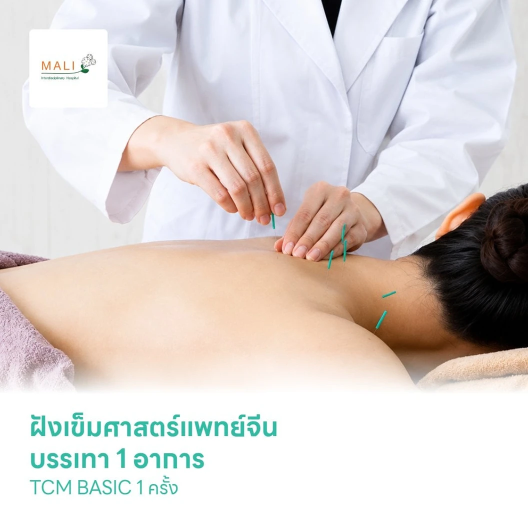 ฝังเข็มศาสตร์แพทย์จีน บรรเทา 1 อาการ TCM BASIC 1 ครั้ง
