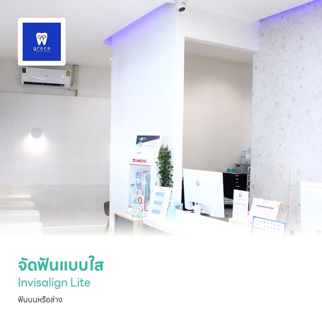 จัดฟันแบบใส Invisalign Lite ฟันบนหรือล่าง