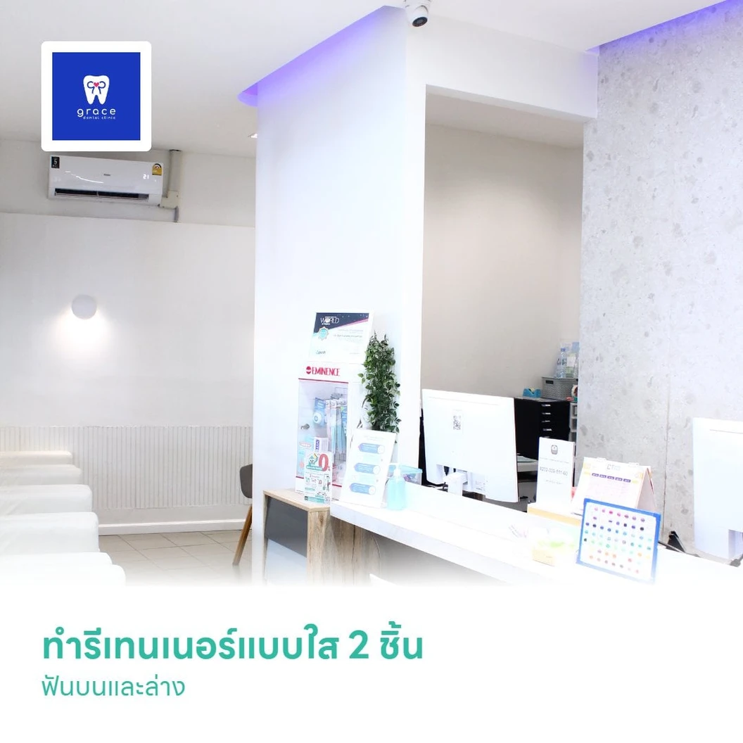 ทำรีเทนเนอร์แบบใส 2 ชิ้น ฟันบนและล่าง