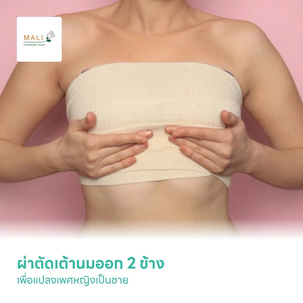 ผ่าตัดเต้านมออก 2 ข้าง เพื่อแปลงเพศหญิงเป็นชาย