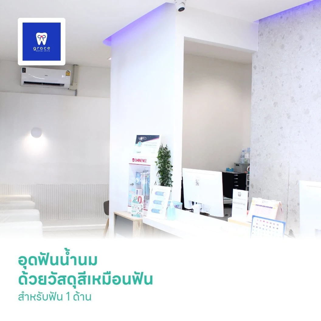 อุดฟันน้ำนม ด้วยวัสดุสีเหมือนฟัน สำหรับฟัน 1 ด้าน