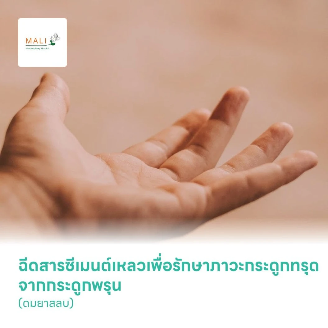 ฉีดสารซีเมนต์เหลวเพื่อรักษาภาวะกระดูกทรุด จากกระดูกพรุน (ดมยาสลบ) Vertebroplasty with out Anesthetic