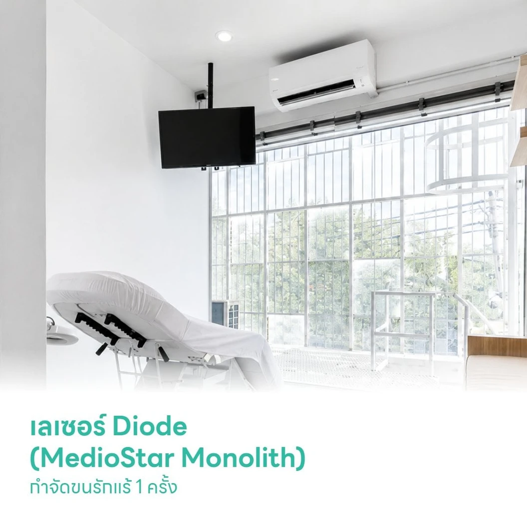 เลเซอร์ Diode (MedioStar Monolith) กำจัดขนรักแร้ 1 ครั้ง