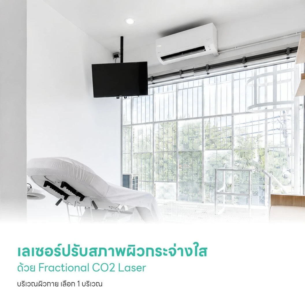 เลเซอร์ปรับสภาพผิวกระจ่างใส ด้วย Fractional CO2 Laser บริเวณผิวกาย เลือก 1 บริเวณ (หลัง แขน ขา หรือ หน้าท้อง) 1 ครั้ง