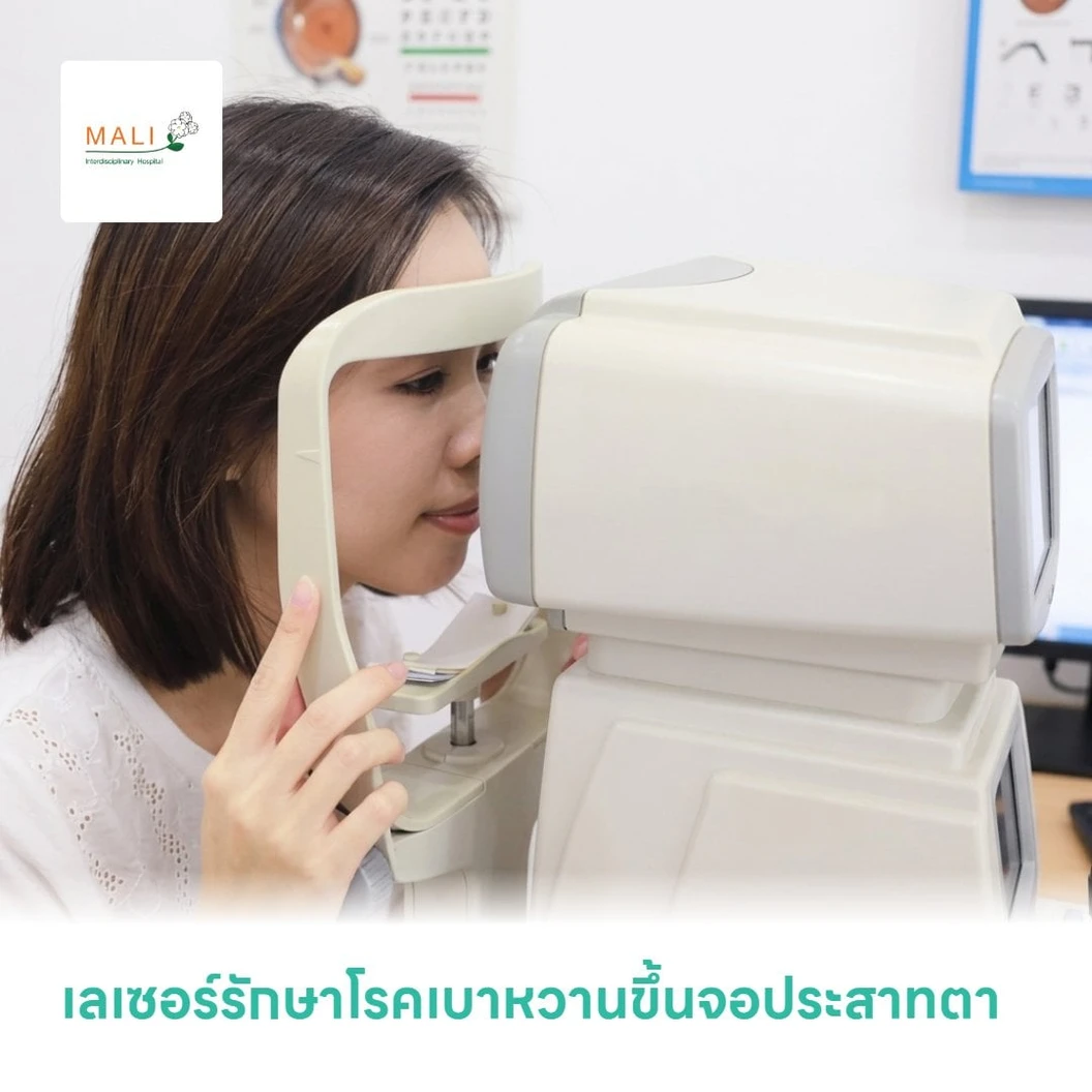 เลเซอร์รักษาโรคเบาหวานขึ้นจอประสาทตา