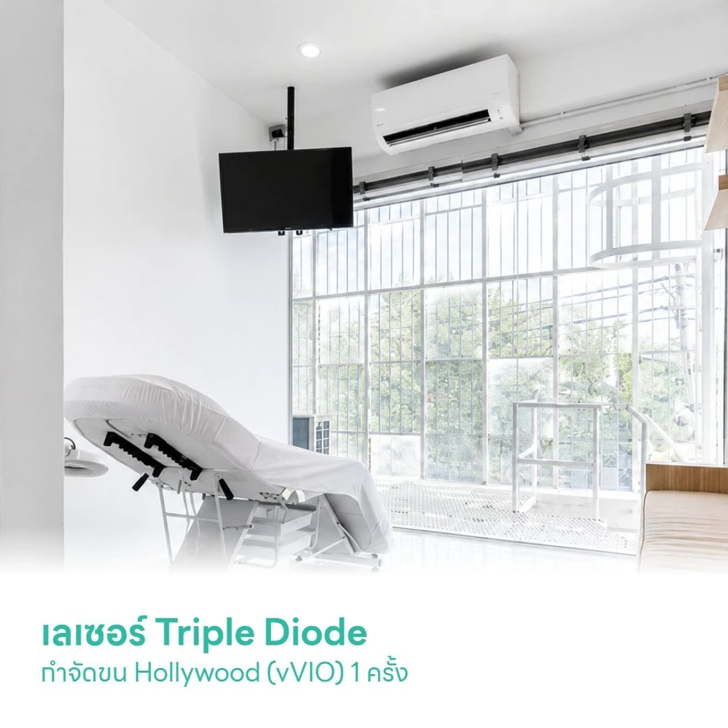 เลเซอร์ Triple Diode กำจัดขน Hollywood (vVIO) 1 ครั้ง