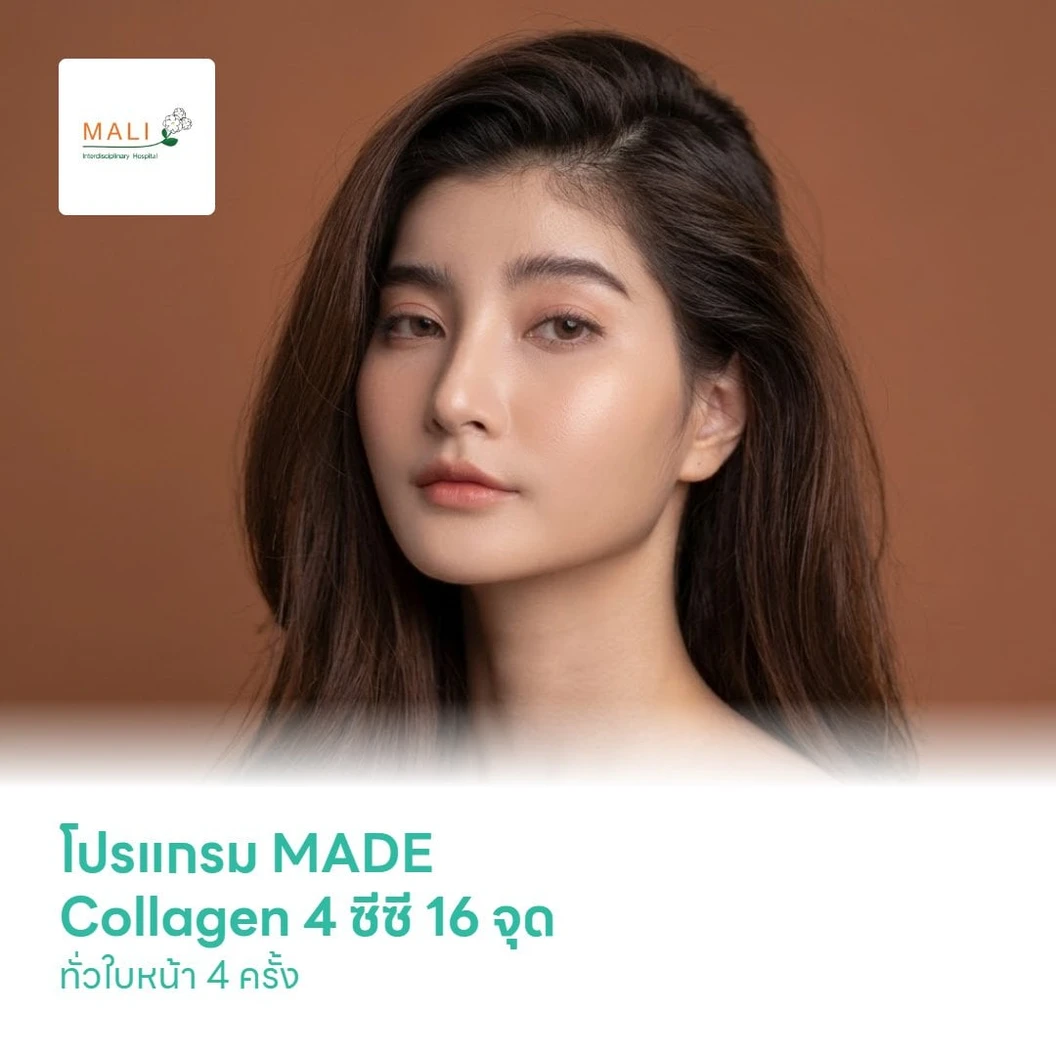 โปรแกรม MADE Collagen 4 ซีซี 16 จุด ทั่วใบหน้า เพื่อลดการเกิดสิว 4 ครั้ง