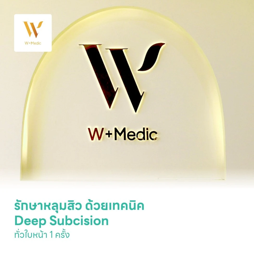 รักษาหลุมสิว ด้วยเทคนิค Deep Subcision ทั่วใบหน้า 1 ครั้ง